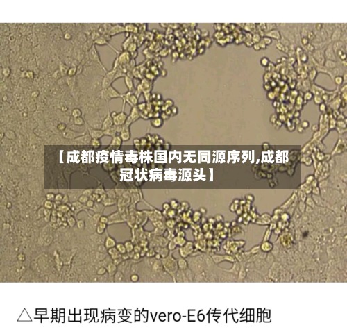 【成都疫情毒株国内无同源序列,成都冠状病毒源头】