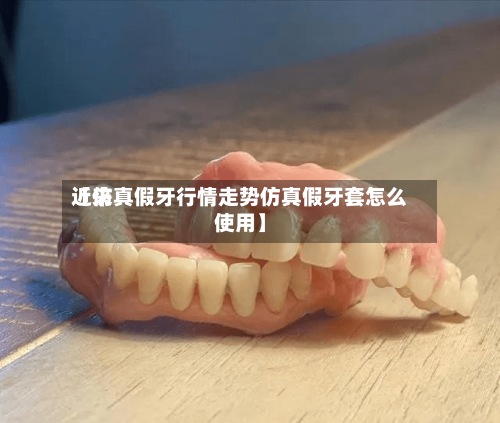 近来【仿真假牙行情走势仿真假牙套怎么使用】-第2张图片
