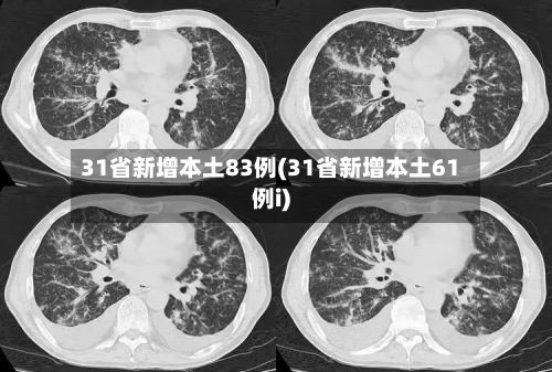31省新增本土83例(31省新增本土61例i)-第2张图片